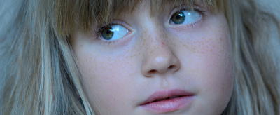 1635511811310 臉上的斑怎么去除