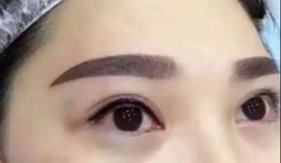 1650427011311 紋完眉多久可以恢復自然