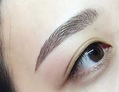 1650589011311 紋完眉多久可以恢復自然