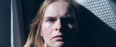 臉上長粉刺是什么原因