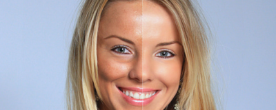 1703405611308 收縮毛孔的方法有什么