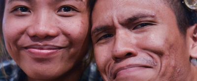 臉上長脂肪粒怎么辦