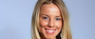 臉部膚色不均怎么辦