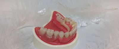 簡單美白牙齒方法