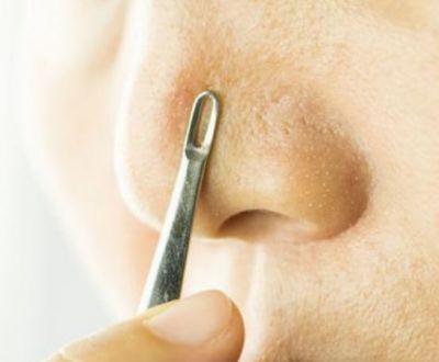 1723183911311 針清后多久可以化妝