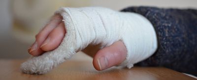 凍瘡是怎么形成的