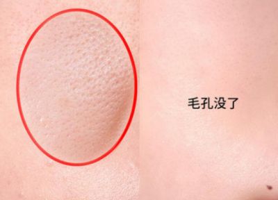 簡單的收縮毛孔方法