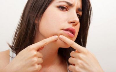 1801113611311 怎么去痘痘痘印改善皮膚