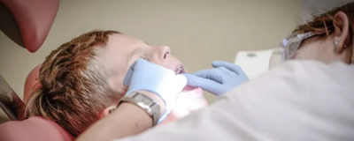 1827339211308 怎么使牙齒變白