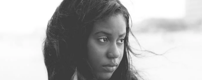 1851475111308 怎么去除臉上的色斑