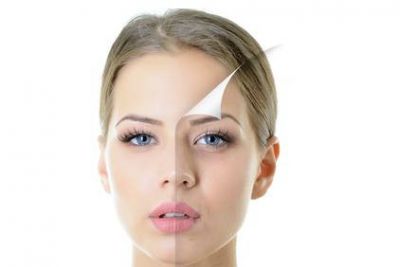 臉部點斑怎么辦