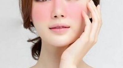 擦護膚品臉上輕微癢癢