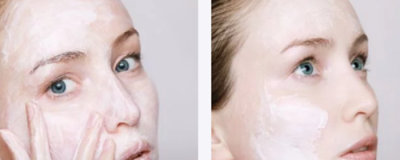 多大之后就不長青春痘了