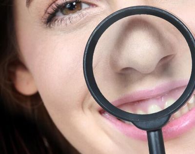 鼻子上的黑頭直接擠掉可以嗎