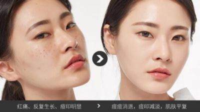 2106242611311 法蘭琳卡蘆薈膠的使用方法