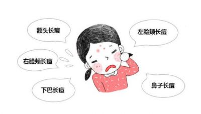 熬夜長痘痘后祛痘方法