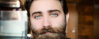 嘴角上火怎么辦