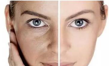 曬黑了多久能恢復 怎么快速變白回