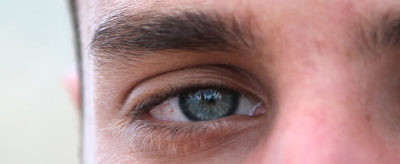 下眼袋怎么消除