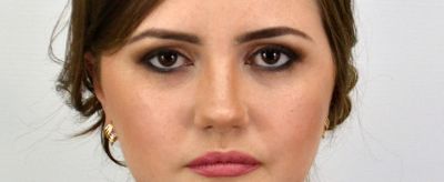 下眼袋怎么消除