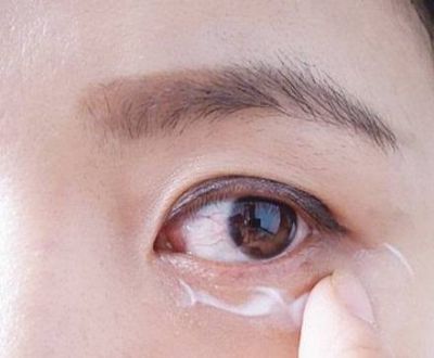 2216026211311 眼周細紋怎么消除