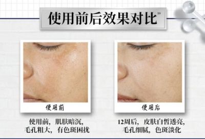 2235041611313 科顏氏淡斑精華怎么查詢真偽