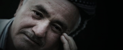 2248415011310 脂肪粒怎么去除小竅門