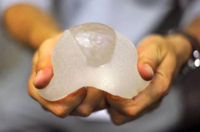 2250067811311 傲諾拉和曼托的區別有哪些