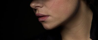 2313081911310 下巴長痘痘是什么原因