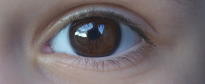 眼睛皮膚松弛怎么辦