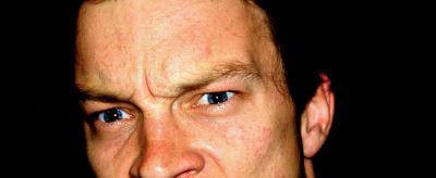 臉上出油是什么原因