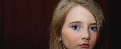 眉毛掉了還會長嗎