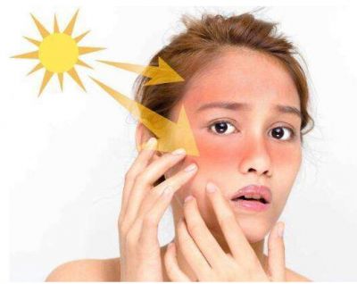 2333481711311 皮膚曬紅了怎樣快速美白