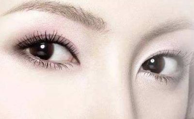 單眼皮可能變雙眼皮嗎