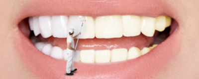 2337138811308 美白牙貼有用嗎