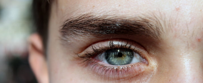 2338146611310 怎么快速去痘疤