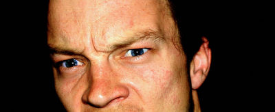 2338166911310 怎么快速去痘疤