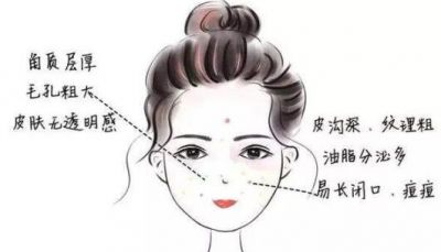 油性皮膚老是長痘怎么辦