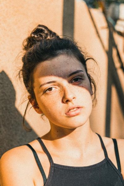 2351179711313 曬斑可以自己消退嗎