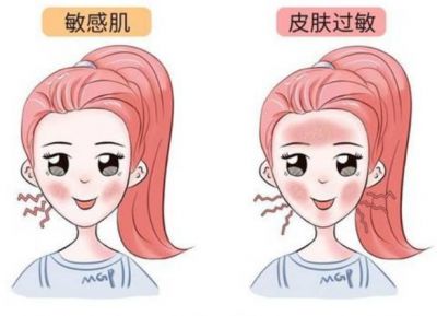怎樣判斷自己是敏感肌