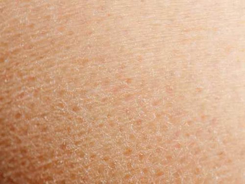 皮膚粗糙不光滑怎么辦